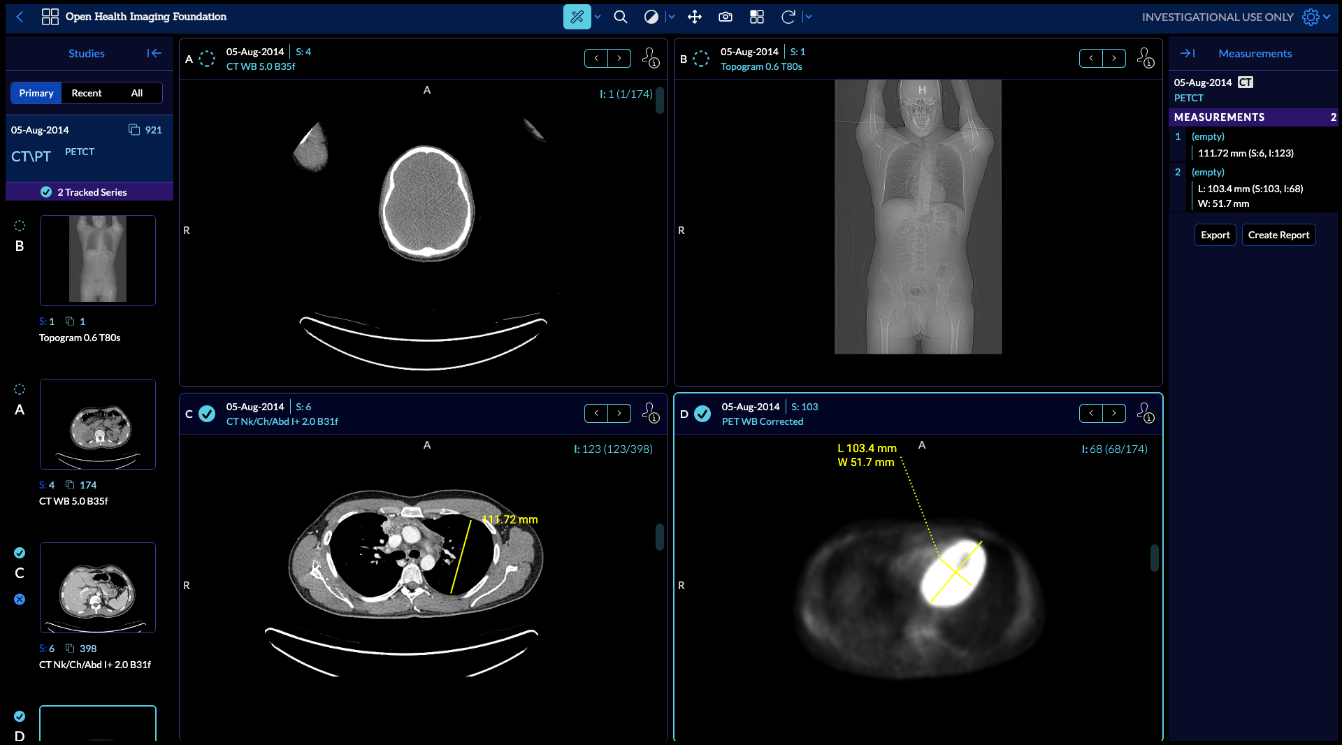 OHIF Viewer Screenshot